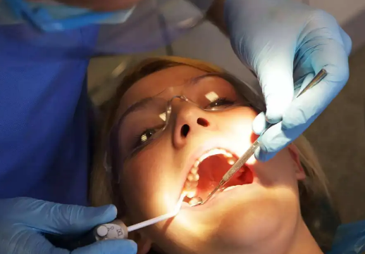 KQ之家：为什么牙医总劝人拔智齿？